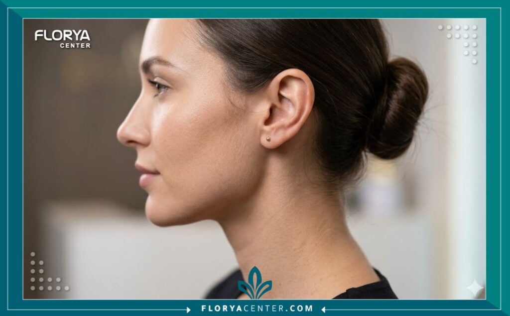 نتائج عملية تجميل الأذن في تركيا تظهر المظهر الطبيعي والمتناسق للأذن.