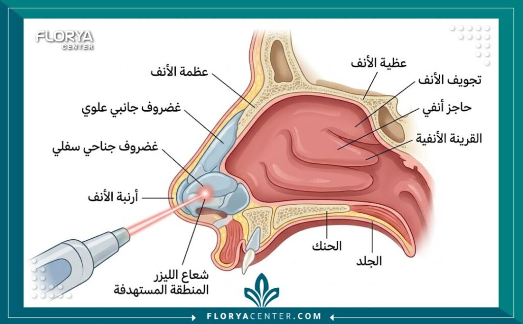 امرأة ذات بشرة نضرة وأنف متناسق بعد إجراء تجميل أرنبة الأنف بالليزر في تركيا، تمثل النتيجة التجميلية المثالية.