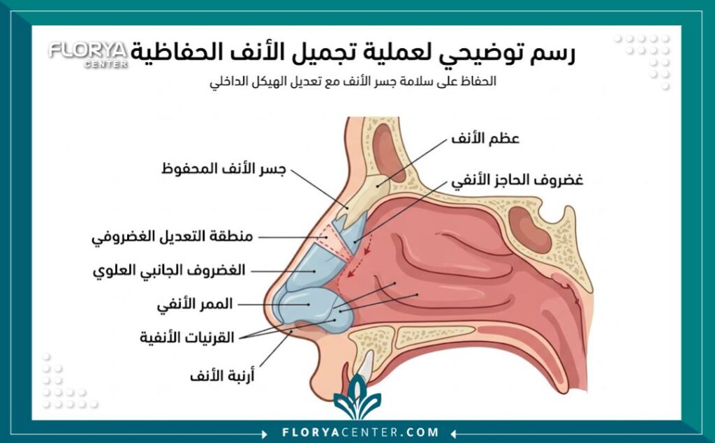 رسم توضيحي لتشريح الأنف يوضح كيفية الحفاظ على ظهر الأنف في عملية تجميل الأنف التحفظية لتجنب مشاكل التنفس.