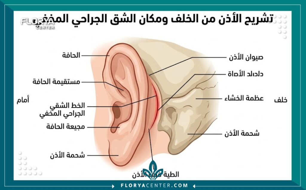 رسم توضيحي طبي يشرح تشريح الأذن ومكان الشق الجراحي المخفي في عملية تجميل الاذن من الخلف.