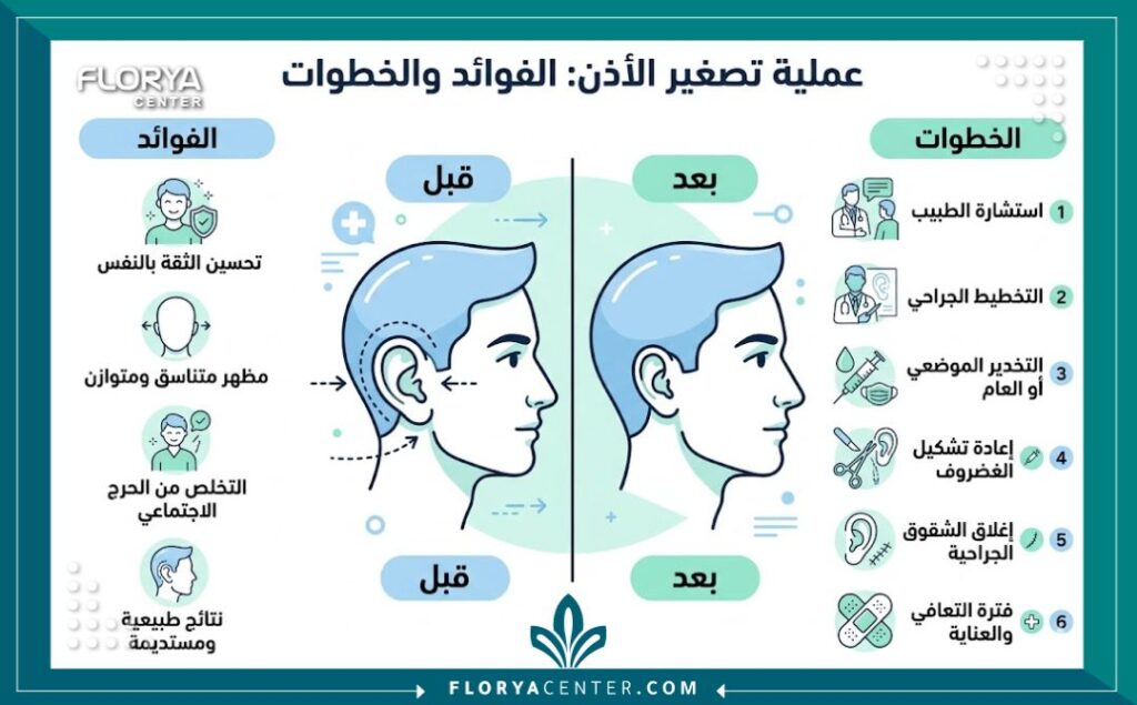 إنفوجرافيك مقارنة يوضح النتائج المتوقعة والفرق قبل وبعد تجميل وتصغير حجم الأذن البارزة.