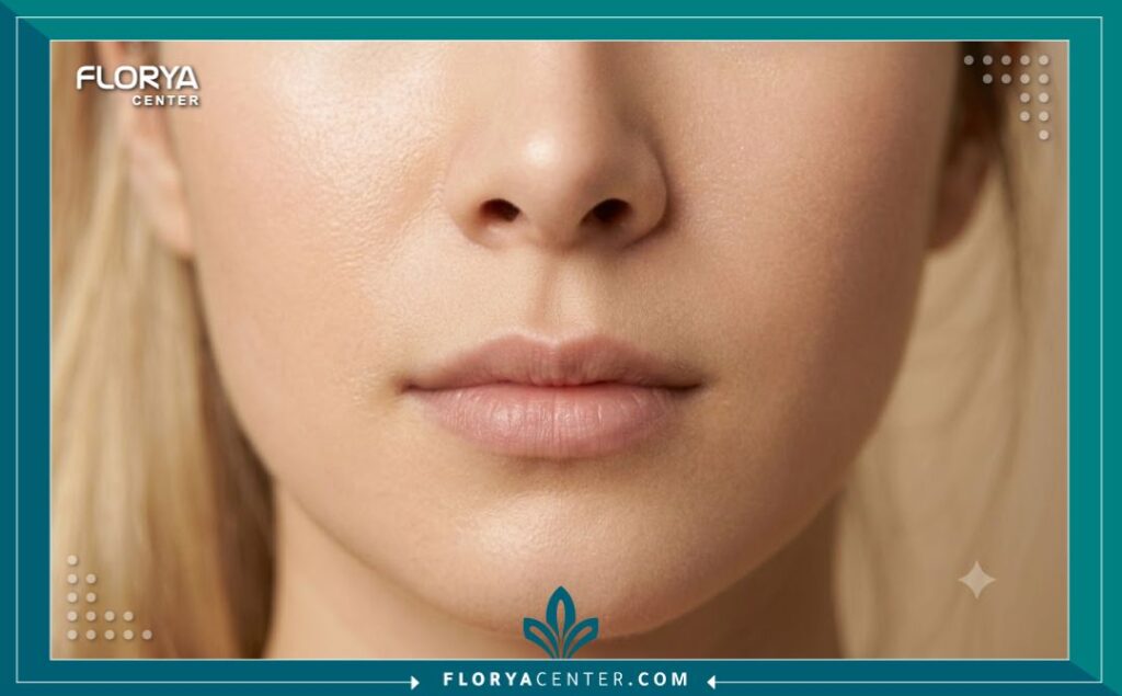 لقطة قريبة تبرز النتيجة الطبيعية والمثالية لعملية تجميل الأنف والتخلص من الفتحات الواسعة جداً.