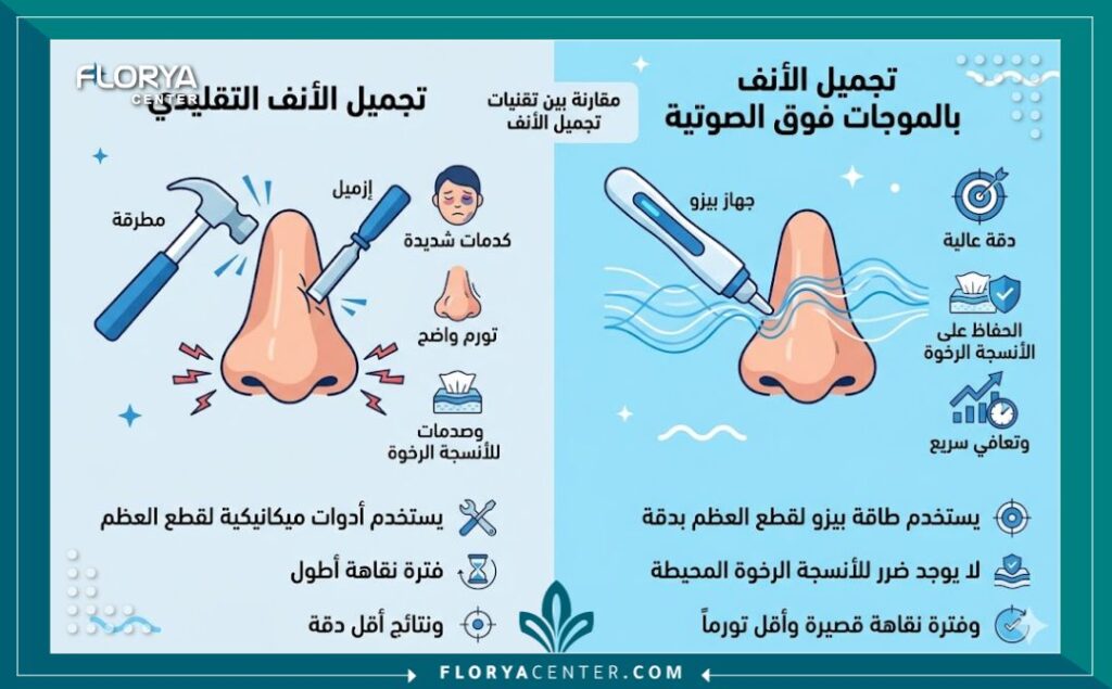 إنفوجرافيك يقارن بين عمليات تجميل الأنف التقليدية وتقنية ألتراسونيك المتقدمة لبيان سرعة التعافي وغياب الكدمات.