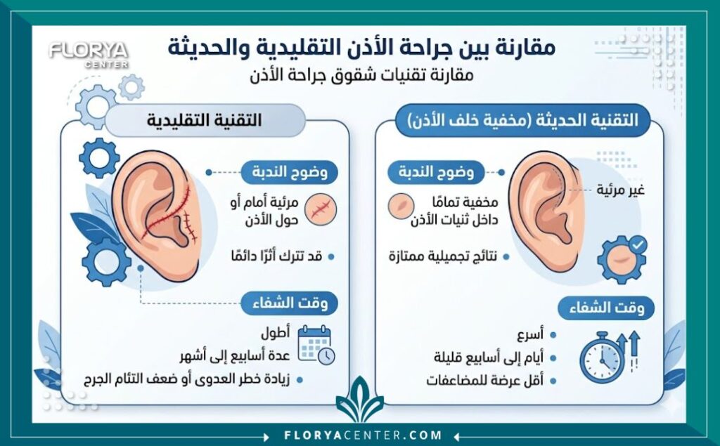 إنفوجرافيك يقارن بين تقنية الشق الجراحي المخفي خلف الأذن والتقنيات التقليدية من حيث إخفاء الندبات وسرعة التعافي.