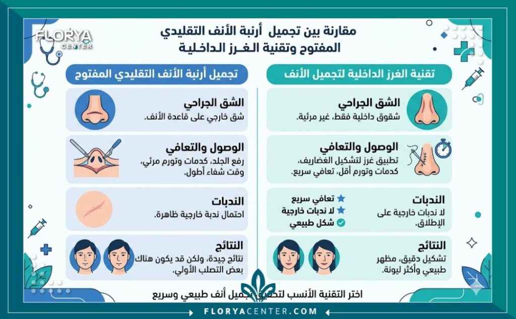 تقنية الغرز الداخلية للأرنبة في تركيا 3 إنفوجرافيك يقارن بين تجميل الأنف التقليدي وتقنية الغرز الداخلية للأرنبة موضحاً مميزات سرعة التعافي وغياب الندبات الخارجية.