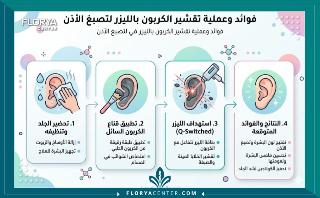 إنفوجرافيك يوضح فوائد وخطوات جلسة التقشير الكربوني لتفتيح وتوريد صيوان الأذن.