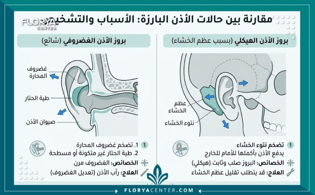 إنفوجرافيك يقارن بين الأذن البارزة الغضروفية وبروز الأذن الهيكلي الناتج عن عظم الخشاء وبرد العظم في حالات بروز الأذن.