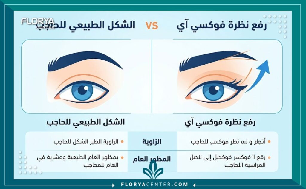 إنفوجرافيك طبي يقارن بين شكل الحاجب الطبيعي وشكل الحاجب بعد عملية شد العين للحصول على نظرة ثعلبية دقيقة تقنية فوكسي آي لتجميل العيون.