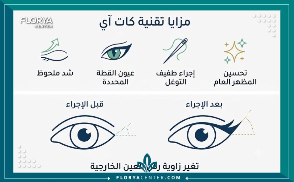 إنفوجرافيك يوضح مقارنة وفوائد تقنية كات آي لتجميل العيون، مع أيقونات وقائمة بالعربية تظهر النتائج المتوقعة والمزايا الرئيسية .