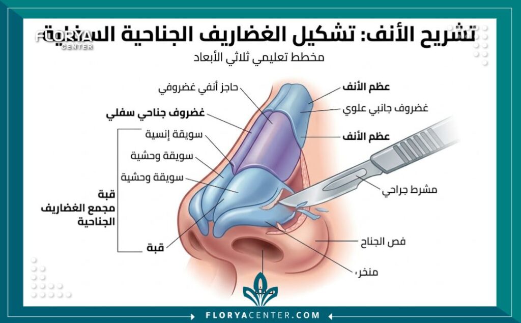 رسم توضيحي طبي دقيق لتشريح الأنف يوضح آلية عمل تقنية نحت الغضروف المشرطية لتعديل الهيكل الغضروفي.