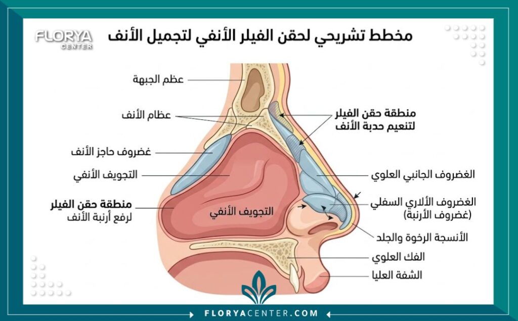 مخطط طبي يوضح تشريح الأنف ومناطق حقن الفيلر لإخفاء عيوب الأنف مؤقتاً.