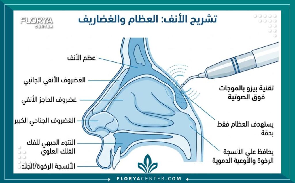 مخطط توضيحي لتقنية البيزو لعملية تجميل الأنف بالأمواج فوق الصوتية