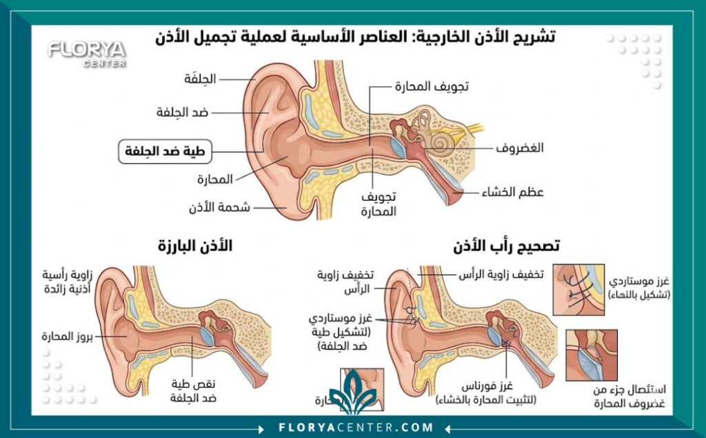 تكلفة جراحة الأذن في تركيا 2 مخطط تشريحي يوضح هيكل غضاريف الأذن لعملية تجميل الأذن الخفاشية