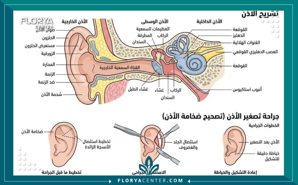 مخطط تشريحي يوضح خطوات عملية قص وتقليص حجم الأذن الكبيرة