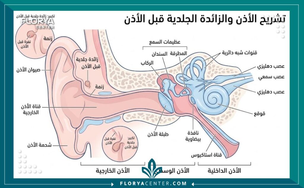 رسم توضيحي طبي دقيق يوضح تشريح الأذن وموقع الزوائد الجلدية أمام الأذن الموروثة في منطقة صيوان الأذن.