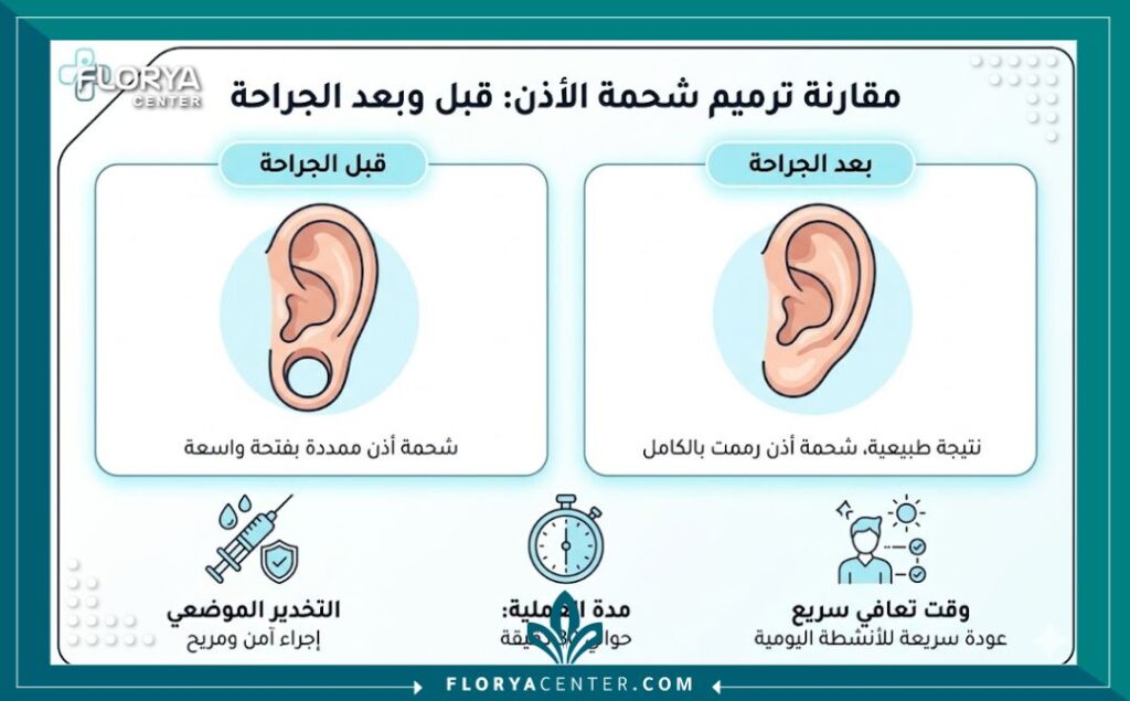 إنفوجرافيك يقارن بين قبل وبعد جراحة إعادة بناء شحمة الأذن مع تفاصيل مدة العملية وفترة التعافي.