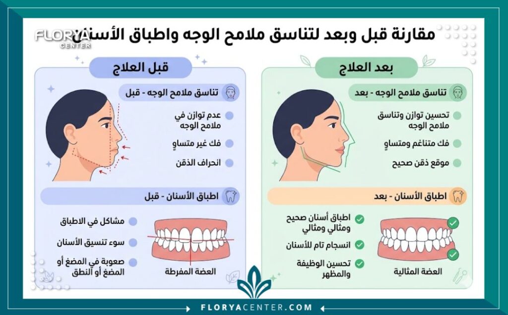 جراحة الأنف والوجه الفكي في تركيا 3 إنفوجرافيك يقارن نتائج تطابق العضة وتناسق الوجه قبل وبعد جراحة الوجه والفكين.