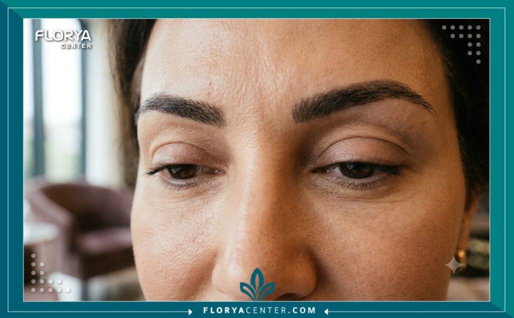 صورة قريبة (كلوز-أب) احترافية تظهر جفون امرأة بوضوح بعد جراحة تجميلية ناجحة في تركيا، مع تركيز على جمال العيون ودقة النتائج النهائية في بيئة هادئة ومضاءة جيدًا.