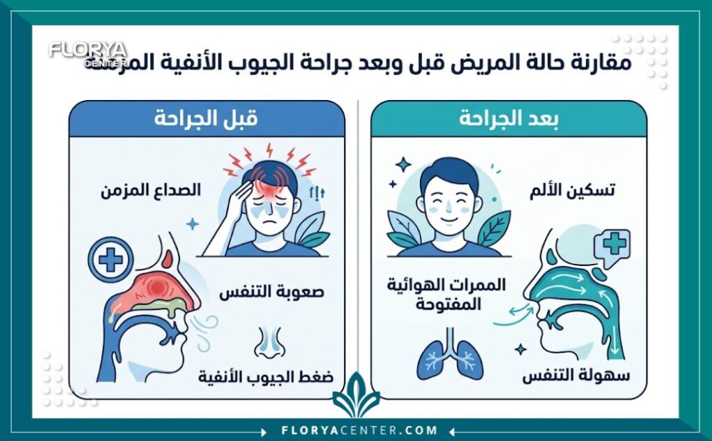 جراحة الجيوب الأنفية المزمنة 3 إنفوجرافيك يقارن بين أعراض التهاب الجيوب الأنفية والصداع المزمن ونتائج عملية تنظيف الجيوب الأنفية.