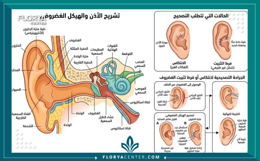 رسم توضيحي طبي لتشريح غضروف الأذن يوضح كيفية إجراء عملية تصحيح تجميل الأذن وتعديل الغضروف.