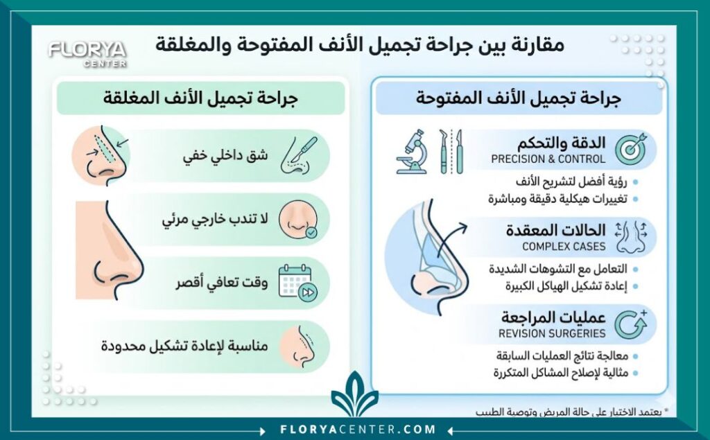 إنفوجرافيك يقارن بين تجميل الأنف المفتوح والمغلق ويوضح مزايا الجراحة المفتوحة لحالات الإعادة المعقدة.