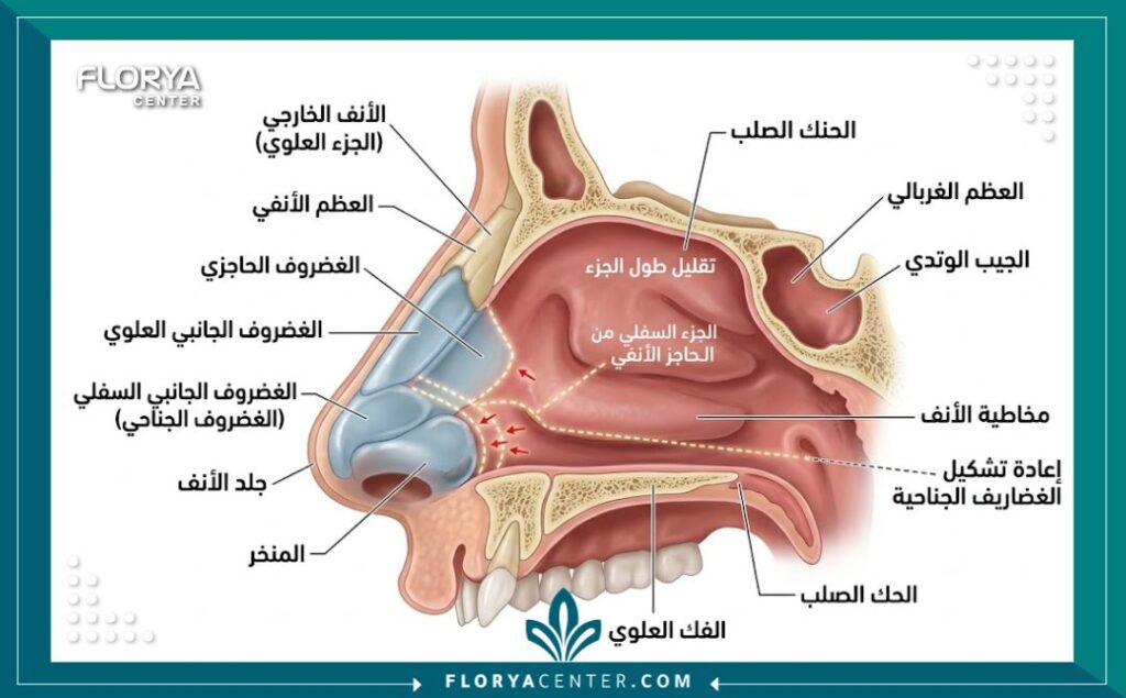 جراحة تقصير الأنف الطويل جراحياً 2 رسم توضيحي طبي لتشريح الأنف الداخلي يوضح الغضاريف والعظام المستهدفة في عملية تقصير الأنف جراحياً.