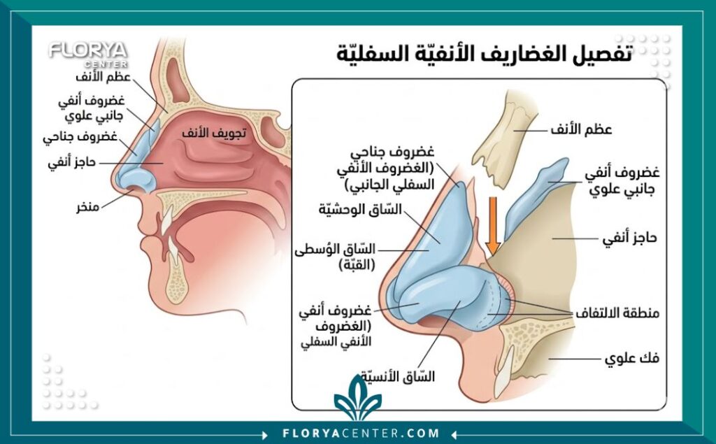 رسم توضيحي طبي يظهر تشريح غضاريف أرنبة الأنف مقارنة بعظمة الأنف لعملية تيبلاستي.