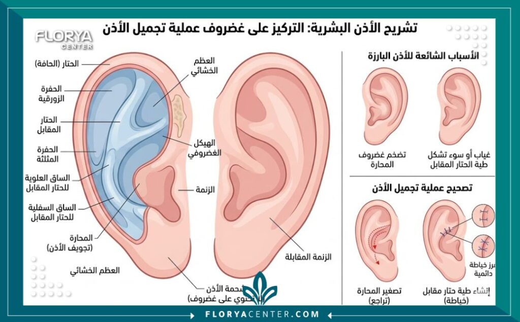 رسم توضيحي طبي لتشريح غضروف الأذن يوضح كيفية إجراء عملية تجميل الأذن البارزة.