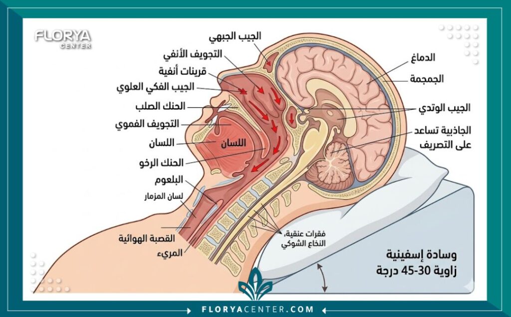 رسم توضيحي طبي يشرح تأثير الجاذبية عند رفع الرأس أثناء النوم لتقليل انتفاخ الأنف بعد التجميل.