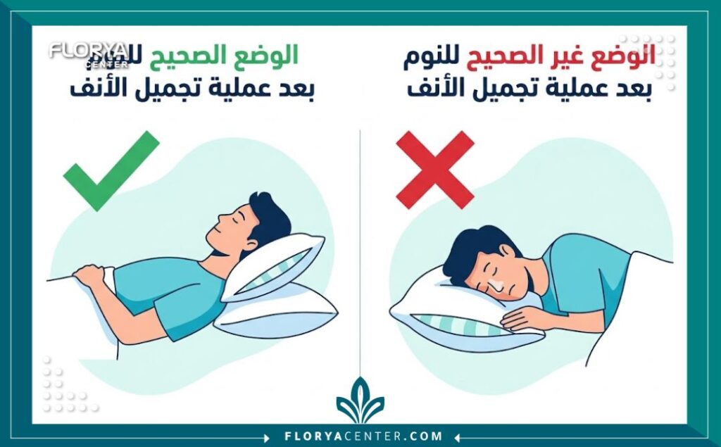 إنفوجرافيك يقارن بين وضعية النوم الصحيحة على الظهر والوضعيات الخاطئة كالنوم على الجنب بعد عملية الأنف.