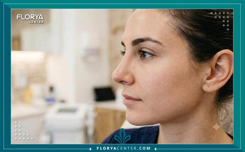 علاج انحراف الأنف في تركيا 5 لقطة جانبية مقربة تبرز استقامة الأنف وتناسقه المثالي بعد الخضوع لعملية تصحيح انحراف الأنف بنجاح والتخلص من الاعوجاج.