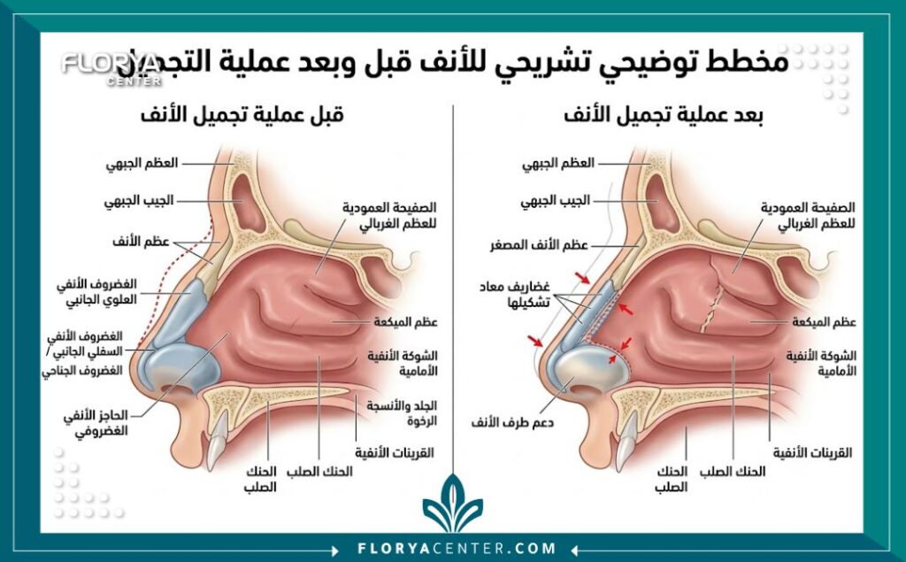 رسم توضيحي طبي دقيق لتشريح الأنف يوضح الهيكل العظمي والغضروفي والتقنيات المستخدمة في تجميل الأنف.