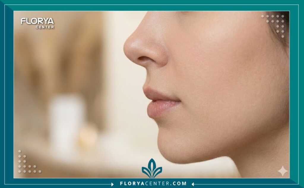 عمليات تجميل الأنف المغلقة في تركيا 5 صورة مقربة لبروفايل أنف مثالي بعد عملية الأنف المغلقة تبرز جمال النتيجة وعدم وجود أي أثر لغرز خارجية.