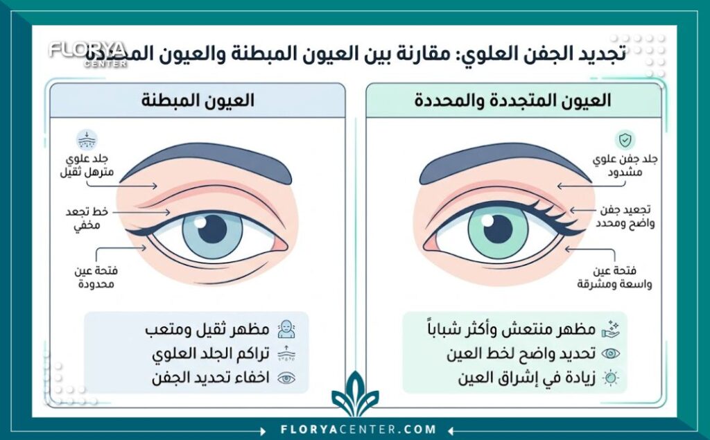 إنفوجرافيك يقارن بوضوح بين شكل الجفن المبطن والنتيجة النهائية بعد إجراء عملية إزالة تبطينة العين.