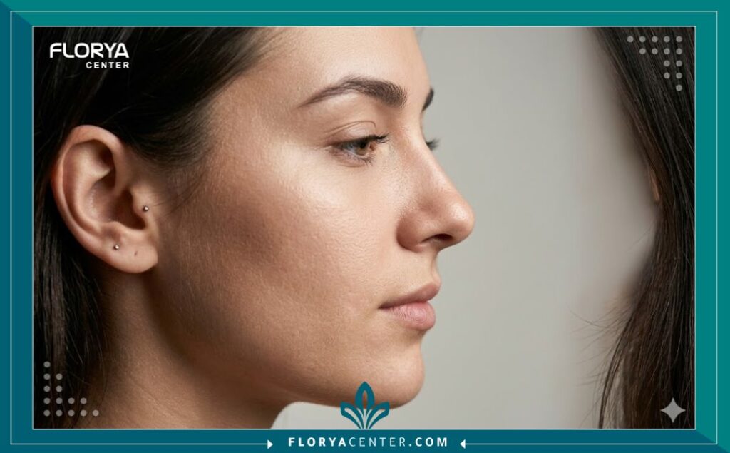 لقطة مقربة توضح النتيجة الطبيعية جداً والمثالية بعد عملية تجميل الأنف التحفظية بدون آثار جراحية.