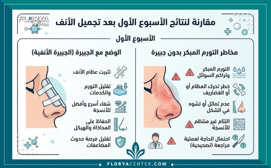 فوائد الجبيرة بعد عملية تجميل الأنف 3 إنفوجرافيك يشرح دور الجبيرة في منع التورم وتثبيت الأنف خلال الأسبوع الأول من جراحة التجميل.