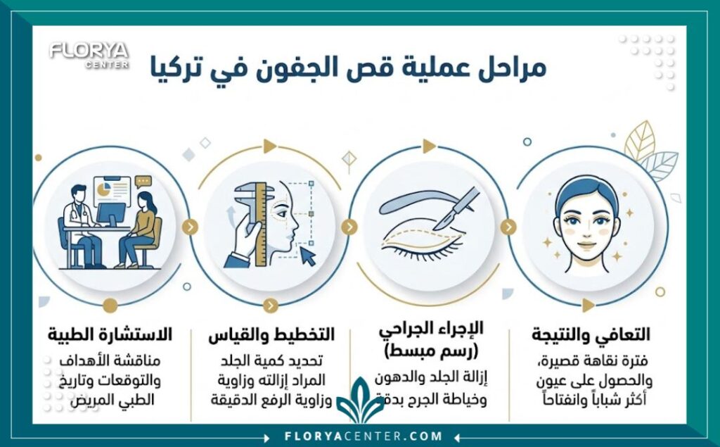  انفوجرافيك يوضح خطوات ومراحل عملية قص الجفون في تركيا بدءاً من الاستشارة وحتى ظهور النتائج النهائية.