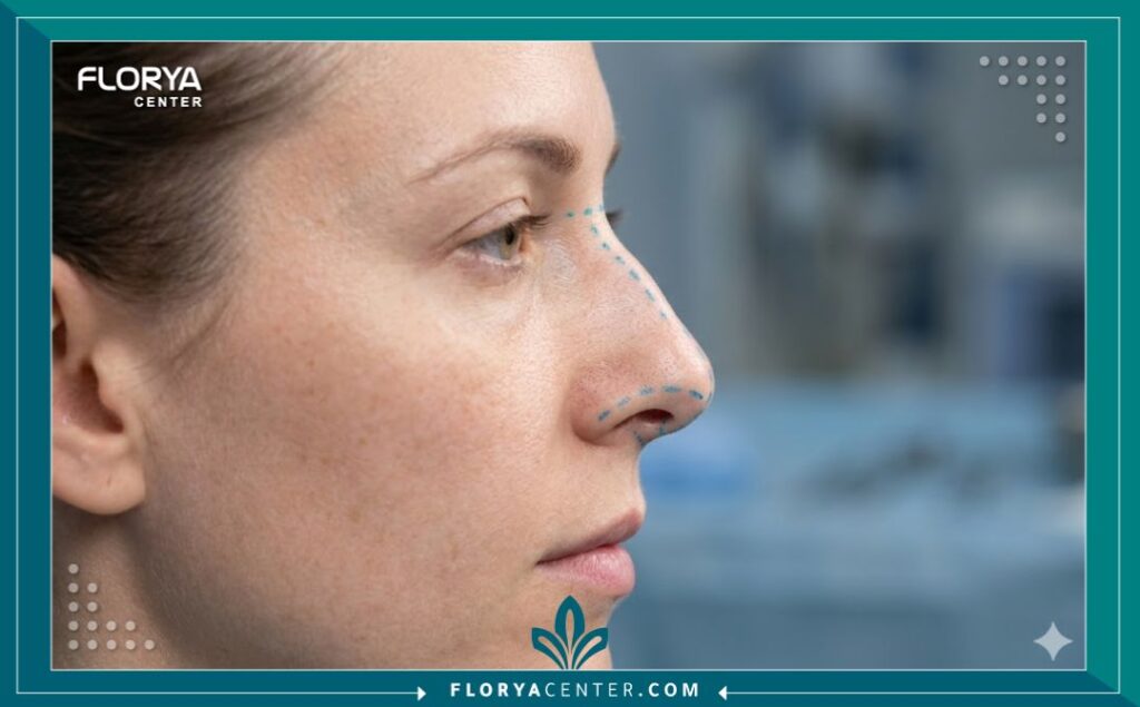 مخاطر عمليات تجميل الأنف 5 صورة مقربة لوجه يوضح التخطيط الجراحي الدقيق وتحديد مسار المشرط لتعديل الحاجز الأنفي، لتجنب مخاطر عمليات تجميل الأنف والتشوهات.