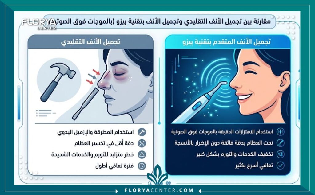 إنفوجرافيك يقارن بين تجميل الأنف التقليدي ونحت الأنف بالموجات الصوتية المتقدمة من حيث الدقة وسرعة التعافي وانعدام الكدمات.