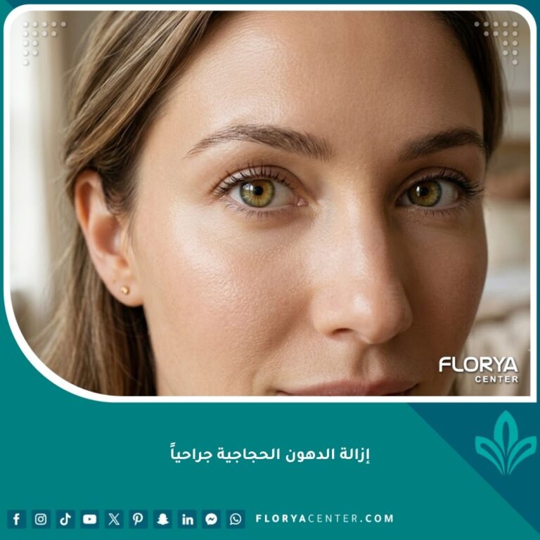 صورة مقربة تظهر عيون نضرة وشابة بعد عملية إزالة الدهون الحجاجية جراحياً للحصول على مظهر مشرق وخالٍ من الانتفاخات.