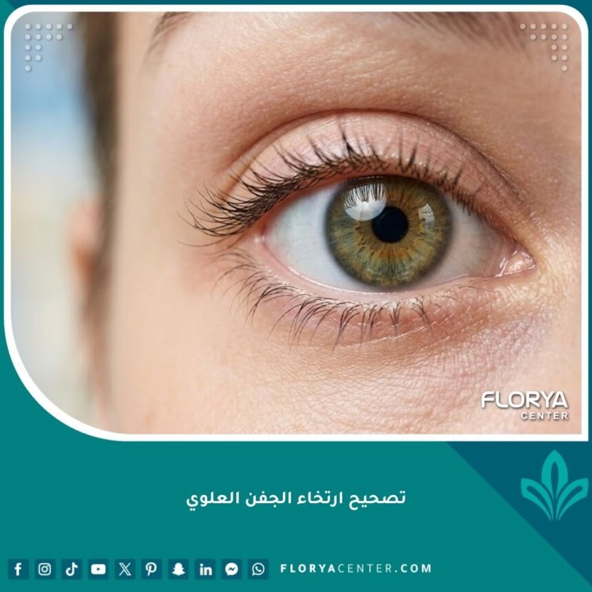 تصحيح ارتخاء الجفن العلوي 1 صورة مقربة لعين واضحة ومشرقة بعد عملية تصحيح ارتخاء الجفن العلوي، تبرز جمال العين وتحسن الرؤية واستعادة وظيفة الجفن الطبيعية.