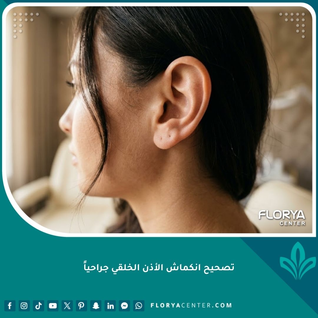 صورة مقربة تظهر النتيجة الطبيعية والمثالية بعد عملية تصحيح انكماش الأذن الخلقي جراحياً في إحدى العيادات المرموقة.