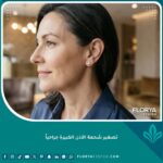 صورة مقربة تبرز نتائج عملية تصغير شحمة الأذن الكبيرة جراحياً لامرأة ترتدي قرطاً أنيقاً.