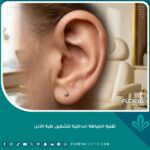 صورة مقربة وواقعية تبرز تناسق وشكل الأذن الطبيعي بعد استخدام تقنية الخياطة الداخلية لتشكيل طية الأذن وعلاج الأذن البارزة.
