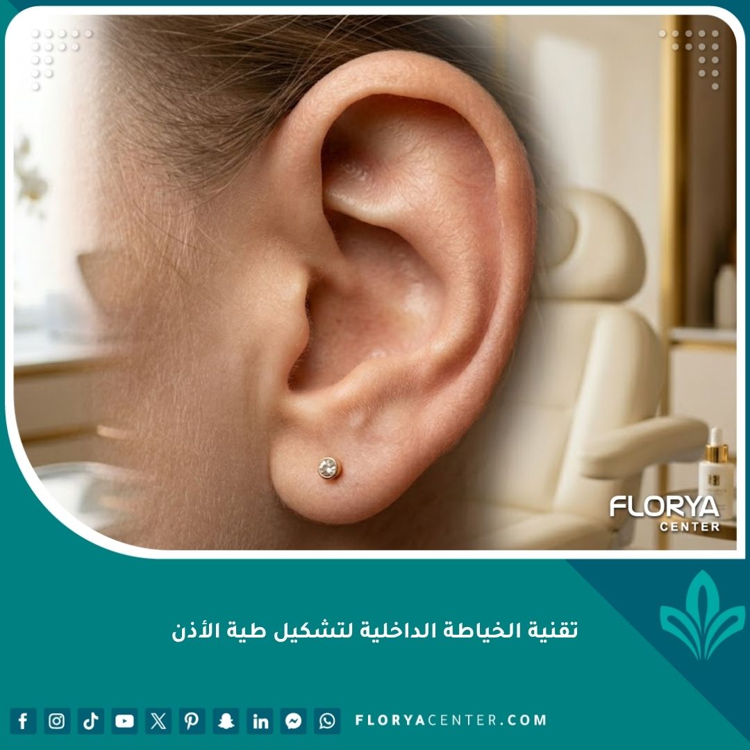 صورة مقربة وواقعية تبرز تناسق وشكل الأذن الطبيعي بعد استخدام تقنية الخياطة الداخلية لتشكيل طية الأذن وعلاج الأذن البارزة.