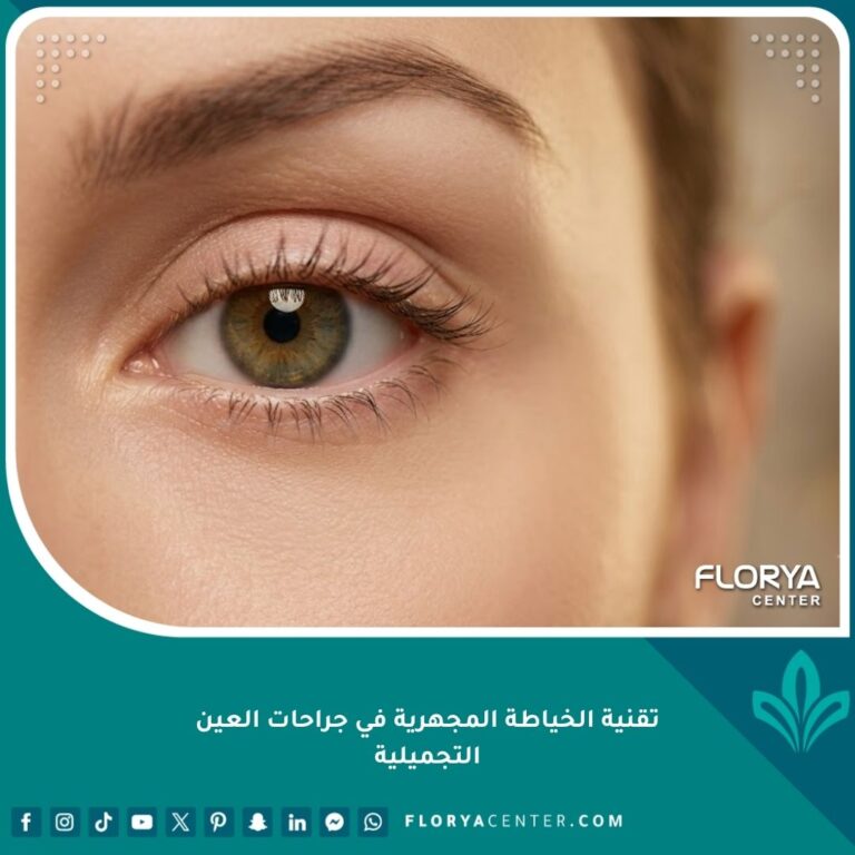 صورة مقربة لعين جذابة وخالية من الندبات تبرز نتائج تقنية الخياطة المجهرية في جراحات العين التجميلية.