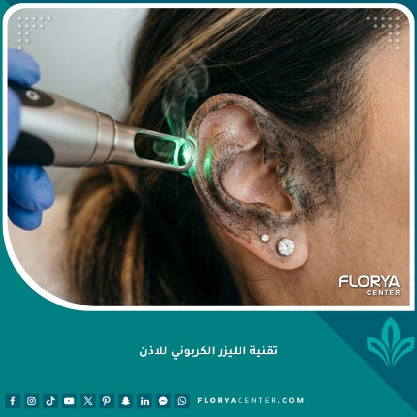 تقنية الليزر الكربوني للاذن لعلاج التصبغات الداكنة وتفتيح لون البشرة في عيادة التجميل.