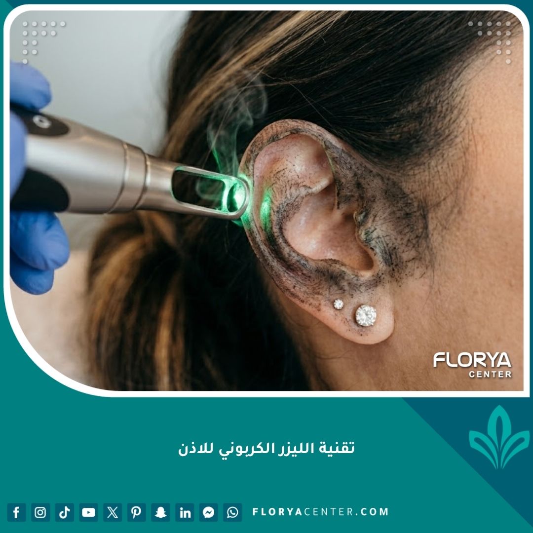 تقنية الليزر الكربوني للاذن لعلاج التصبغات الداكنة وتفتيح لون البشرة في عيادة التجميل.