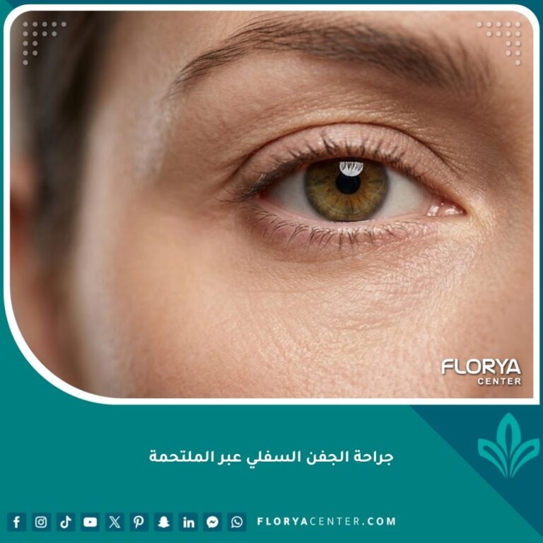 جراحة الجفن السفلي عبر الملتحمة لإزالة دهون العين من الداخل مظهر طبيعي بدون ندوب