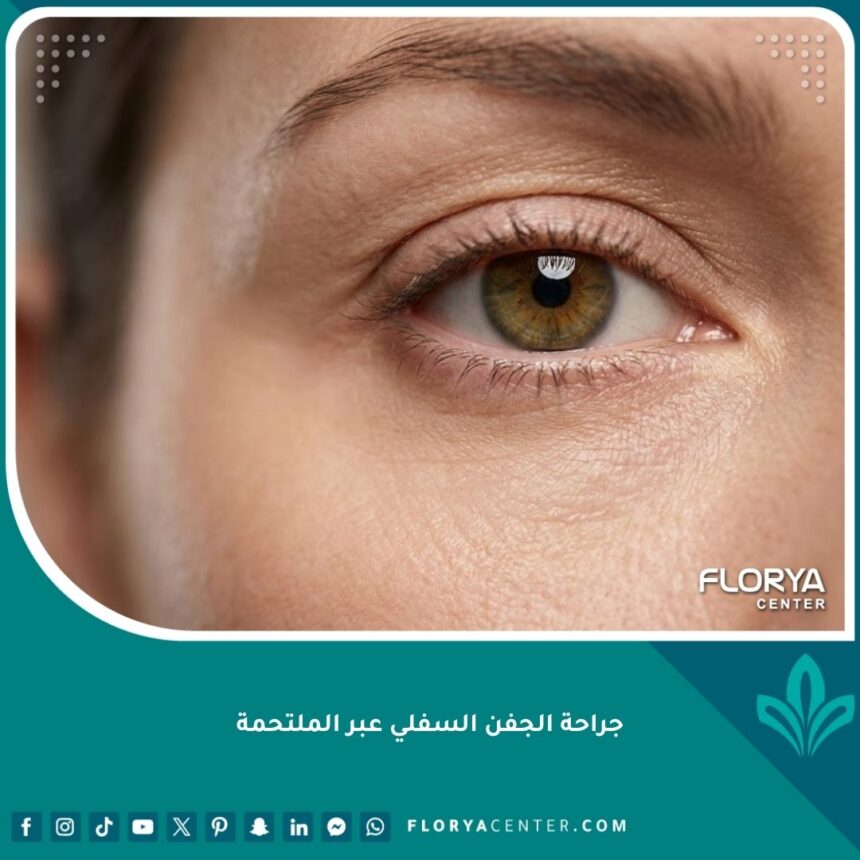 جراحة الجفن السفلي عبر الملتحمة لإزالة دهون العين من الداخل مظهر طبيعي بدون ندوب